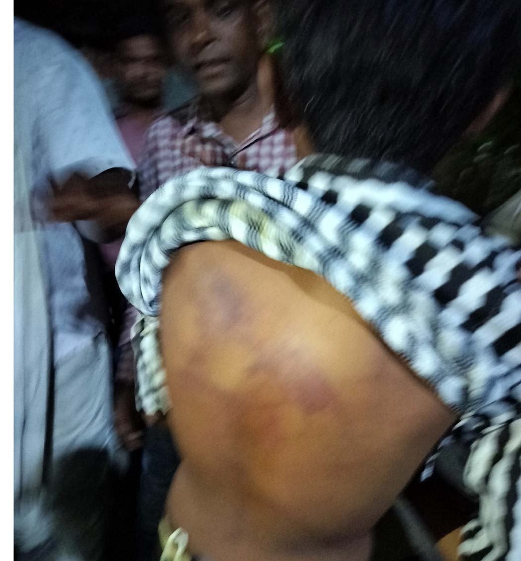 Tribal student of Eklavya Vidyalaya Kesla beaten up on suspicion of theft, FIR lodged
